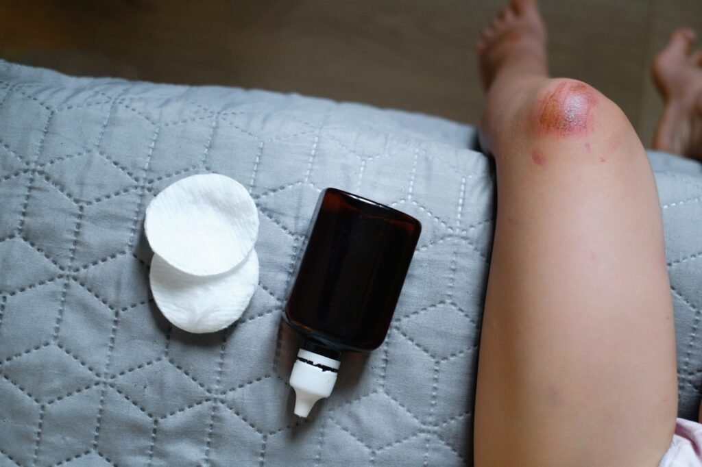 Wounded knee, first aid for child at home. Copy space
